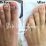 Does Nail Polish Cause Toenail Fungus?