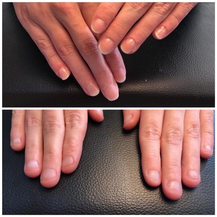 Nails damaged acrylics damage ways article repairing